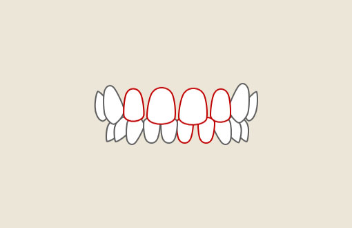 すきっ歯（歯と歯の間にすきまがある）